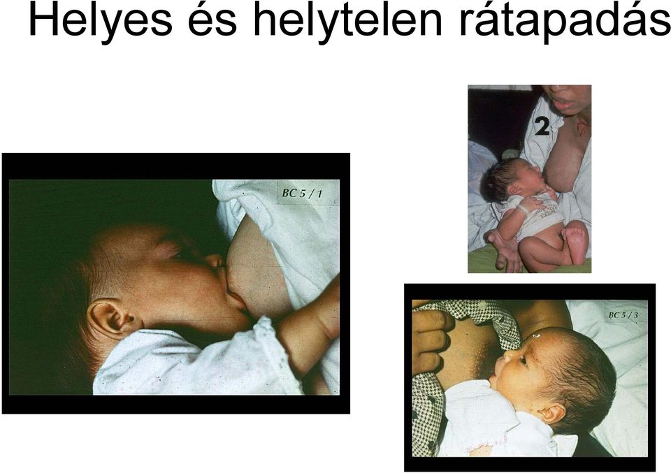 rátapadás