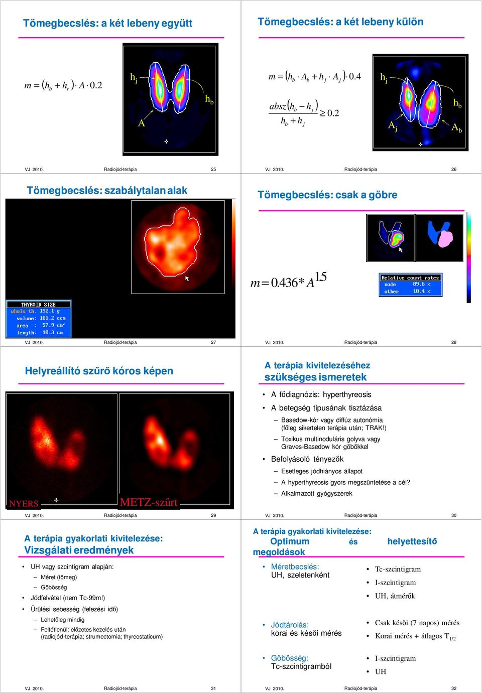 A 27 28 Helyreállító szőrı kóros képen NYERS METZ-szőrt 29 A terápia gyakorlati kivitelezése: Vizsgálati eredmények UH vagy szcintigram alapán: Méret (tömeg) Göösség Jódfelvétel (nem Tc-99m!