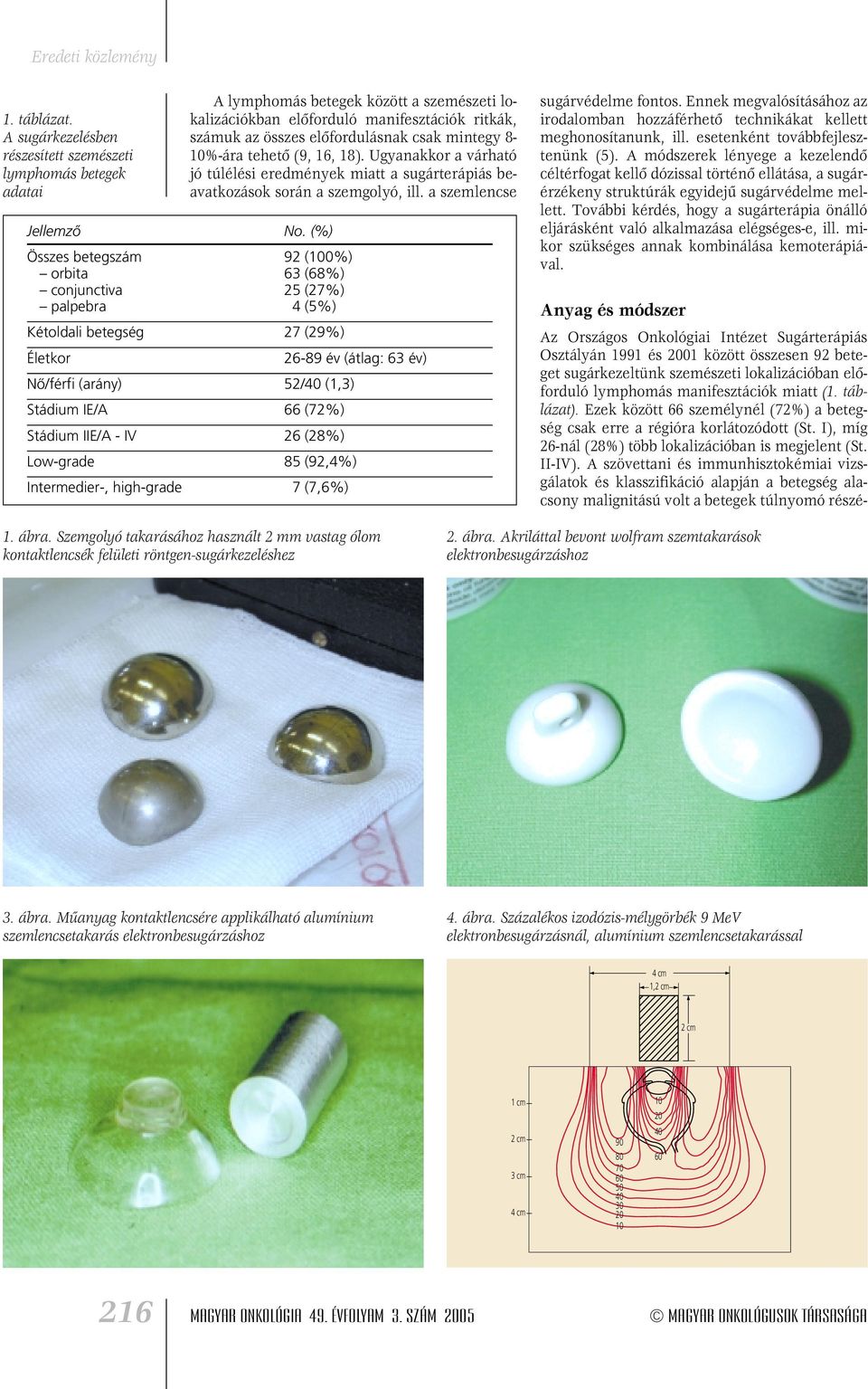 mintegy 8-10%-ára tehetô (9, 16, 18). Ugyanakkor a várható jó túlélési eredmények miatt a sugárterápiás beavatkozások során a szemgolyó, ill. a szemlencse Jellemzô No.