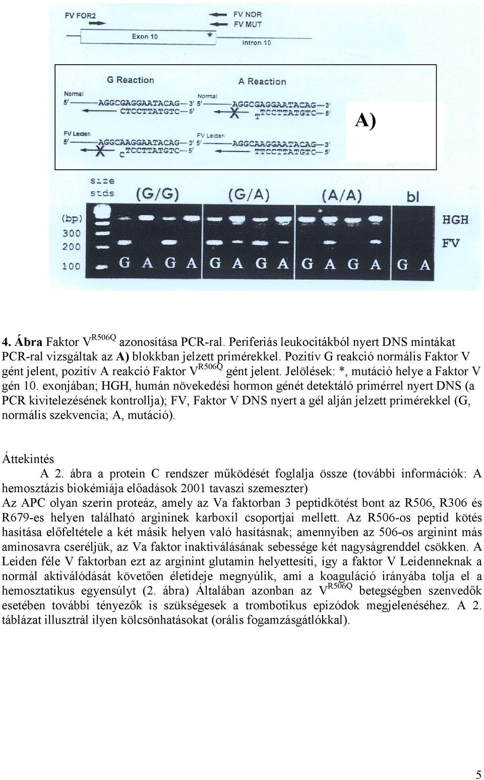 exonjában; HGH, humán növekedési hormon génét detektáló primérrel nyert DNS (a PCR kivitelezésének kontrollja); FV, Faktor V DNS nyert a gél alján jelzett primérekkel (G, normális szekvencia; A,