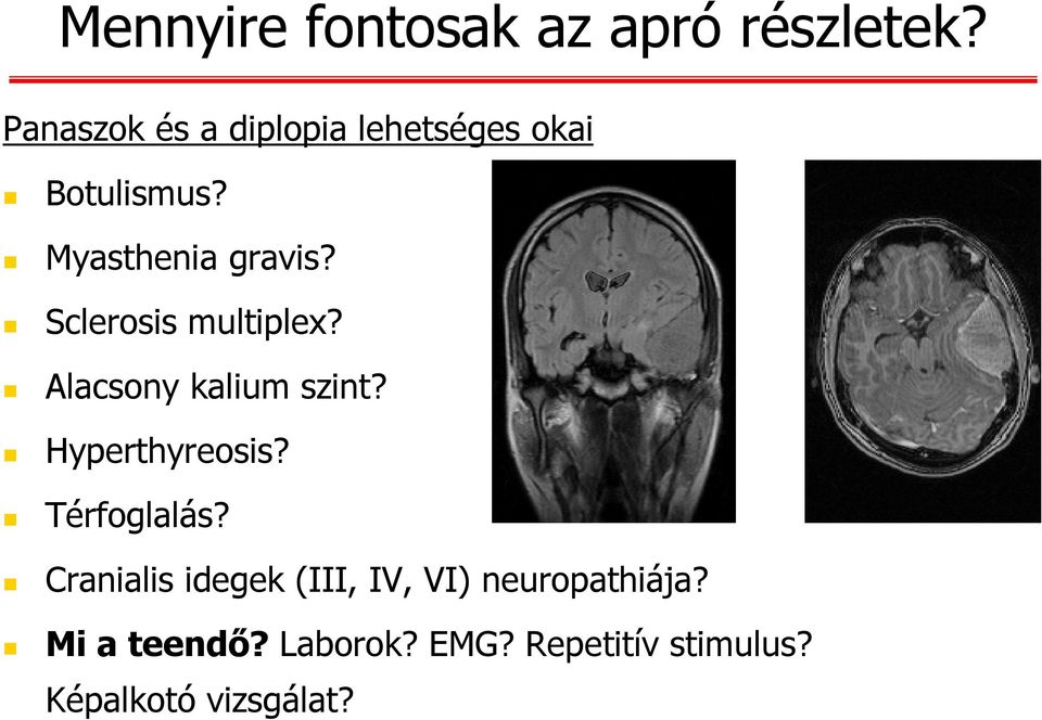 Sclerosis multiplex? Alacsony kalium szint? Hyperthyreosis? Térfoglalás?