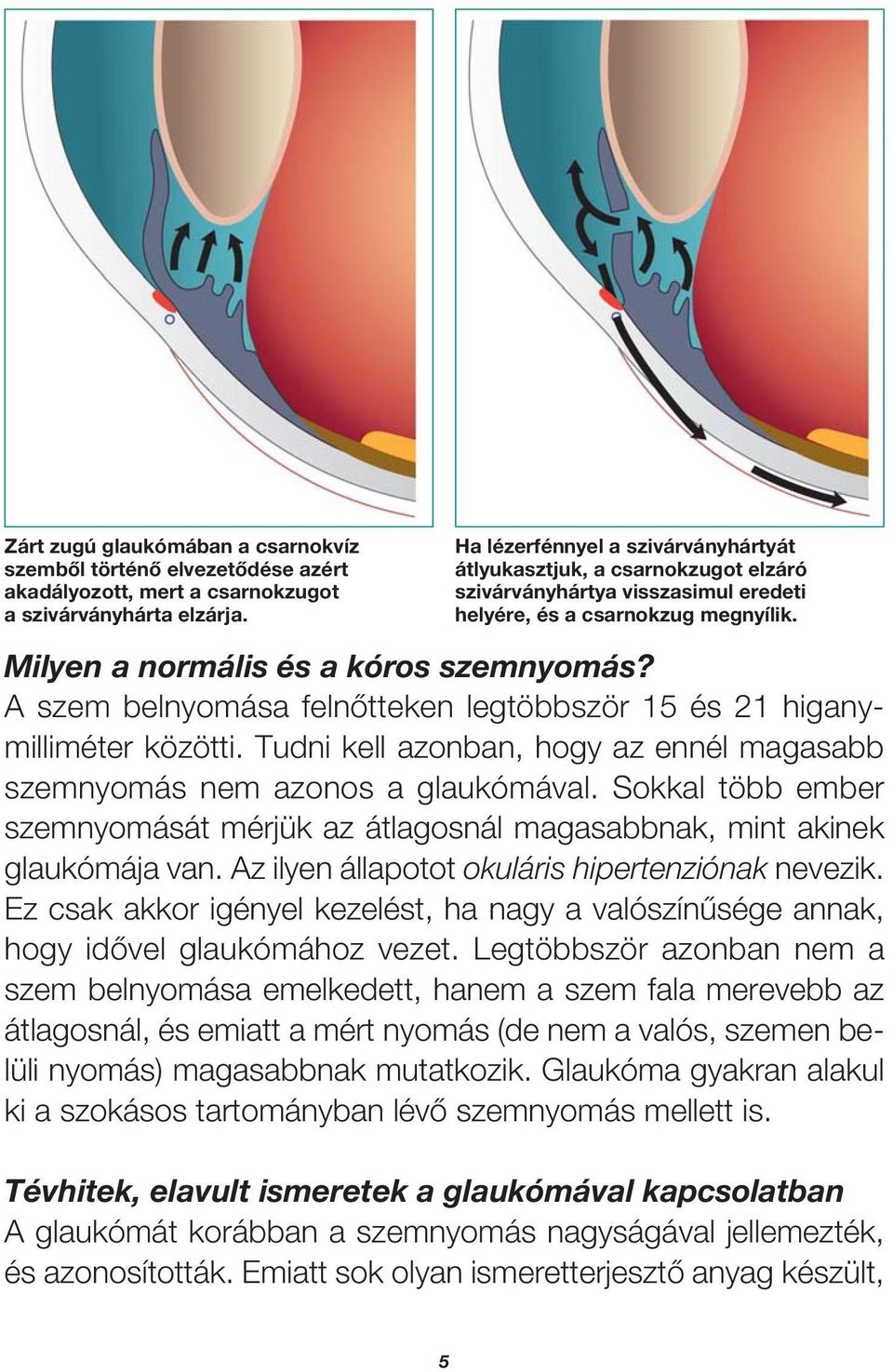 A szem belnyomása felnôtteken legtöbbször 15 és 21 higanymilliméter közötti. Tudni kell azonban, hogy az ennél magasabb szemnyomás nem azonos a glaukómával.