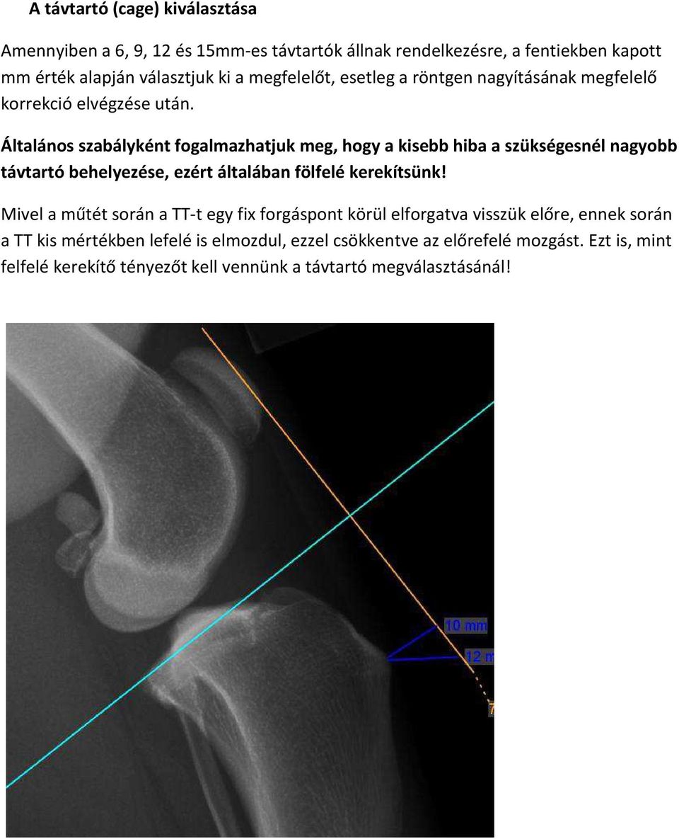 Általános szabályként fogalmazhatjuk meg, hogy a kisebb hiba a szükségesnél nagyobb távtartó behelyezése, ezért általában fölfelé kerekítsünk!