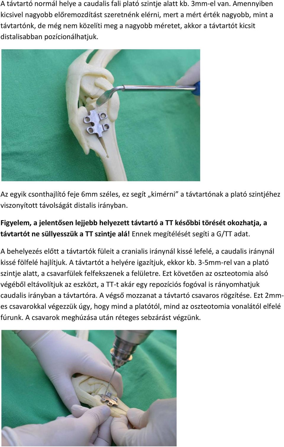 pozícionálhatjuk. Az egyik csonthajlító feje 6mm széles, ez segít kimérni a távtartónak a plató szintjéhez viszonyított távolságát distalis irányban.