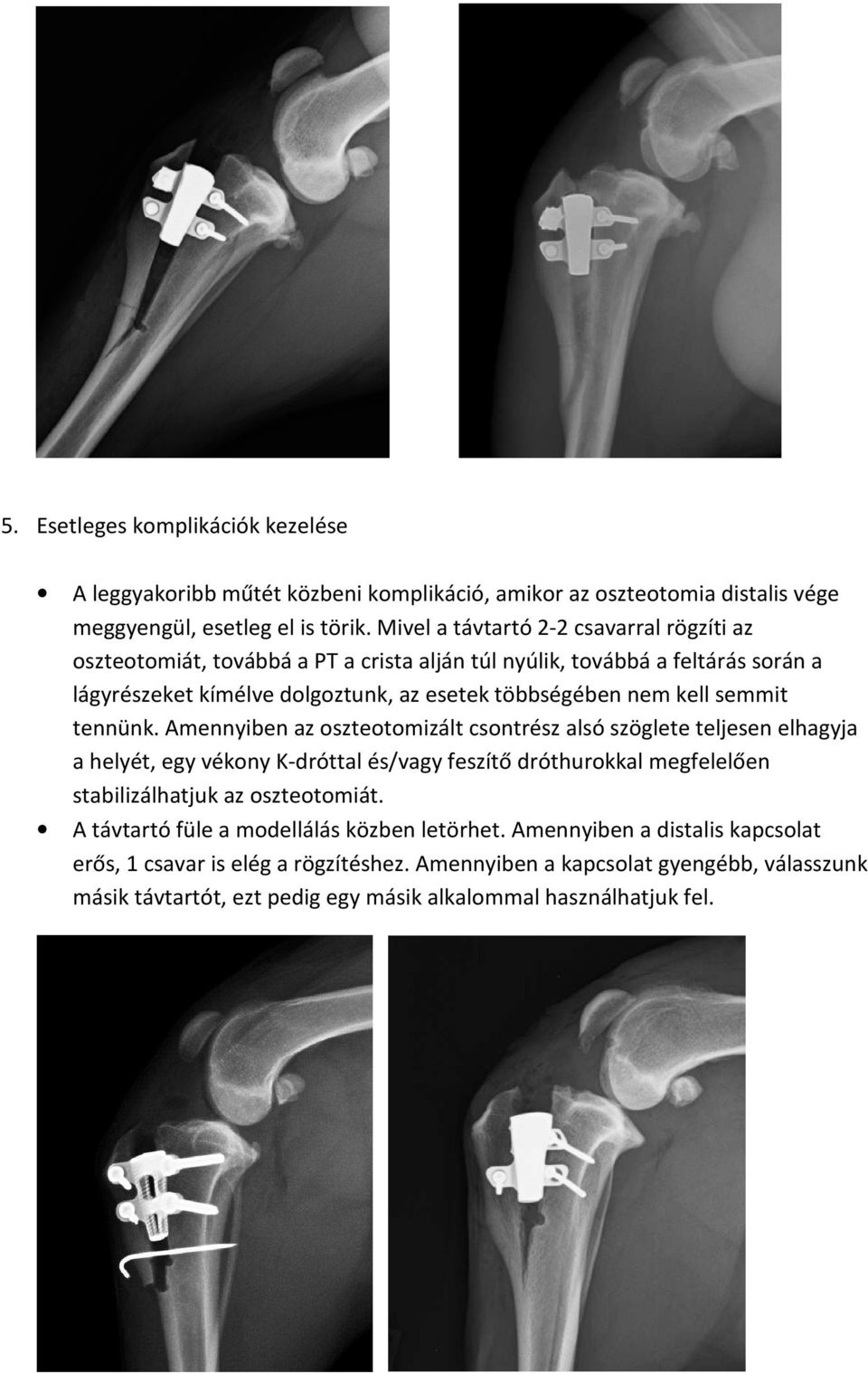 semmit tennünk.