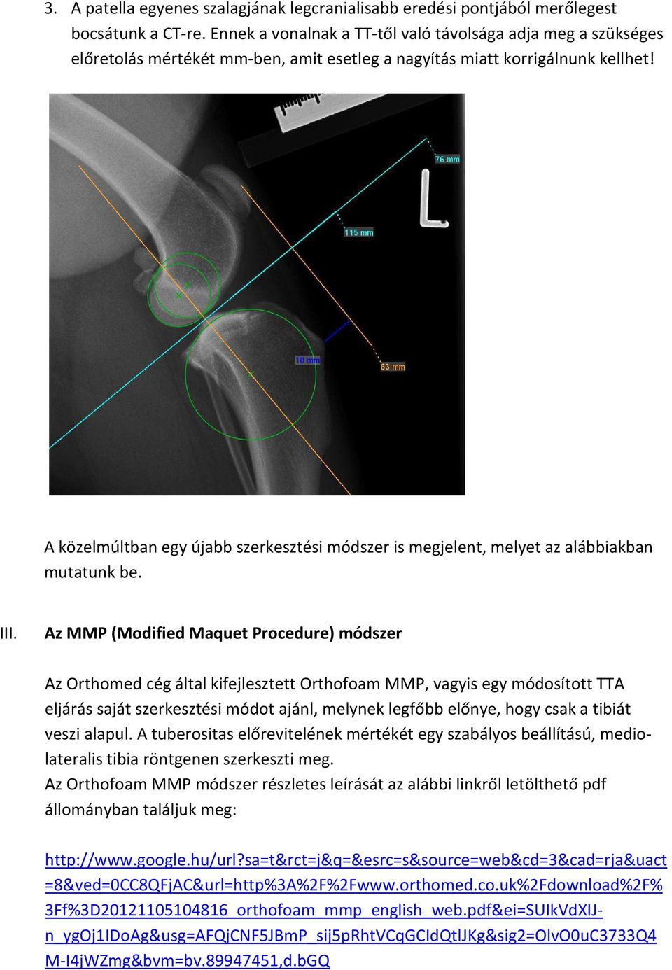 A közelmúltban egy újabb szerkesztési módszer is megjelent, melyet az alábbiakban mutatunk be. III.