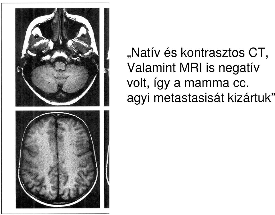 volt, így a mamma cc.