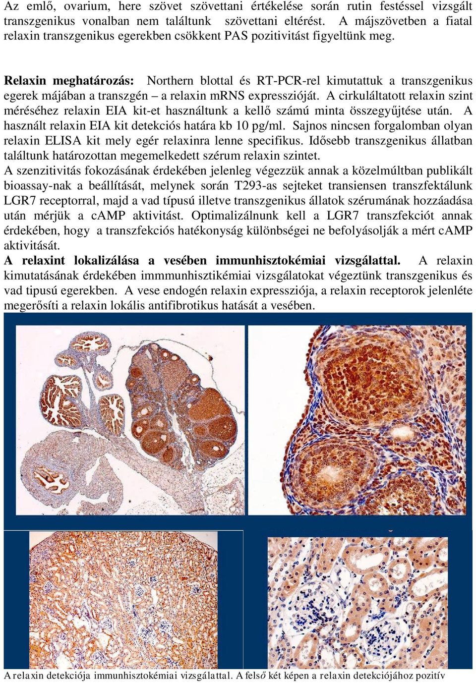 Relaxin meghatározás: Northern blottal és RT-PCR-rel kimutattuk a transzgenikus egerek májában a transzgén a relaxin mrns expresszióját.