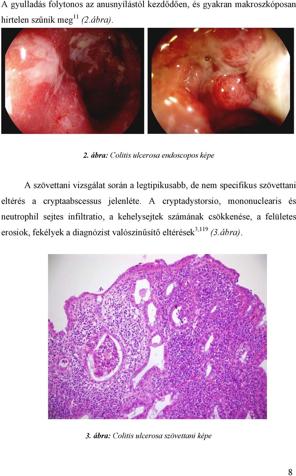 a cryptaabscessus jelenléte.