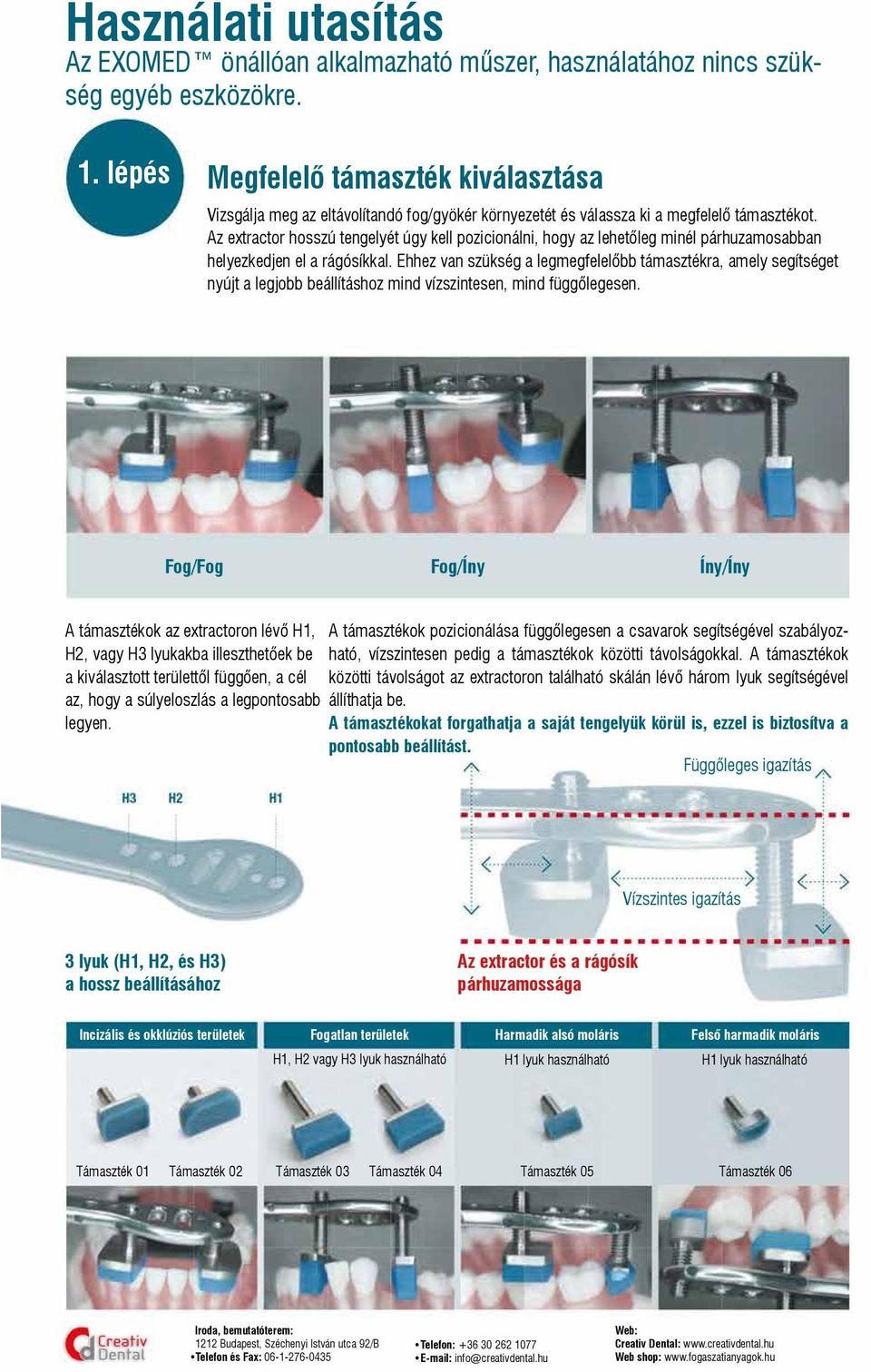 Az extractor hosszú tengelyét úgy kell pozicionálni, hogy az lehetőleg minél párhuzamosabban helyezkedjen el a rágósíkkal.