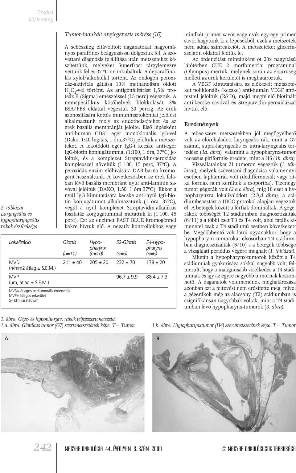 Az endogén peroxidáz-aktivitás gátlása 10% methanolban oldott H 2 O 2 -vel történt. Az antigénfeltárást 1,5% proteáz K (Sigma) emésztéssel (15 perc) végeztük.