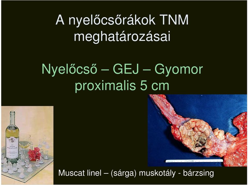 Gyomor proximalis 5 cm