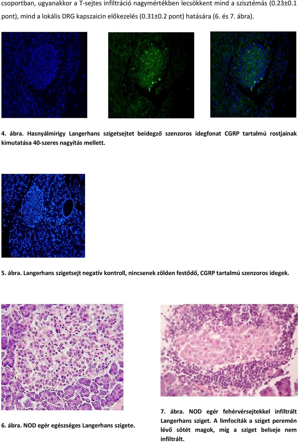 . 4. bra. Hasny lmirigy Langerhans szigetsejtet beidegző szenzoros idegfonat CGRP tartalmˆ rostjainak kimutat sa 40-szeres nagyšt s mellett. 5. bra. Langerhans szigetsejt negatšv kontroll, nincsenek z lden festődő, CGRP tartalmˆ szenzoros idegek.