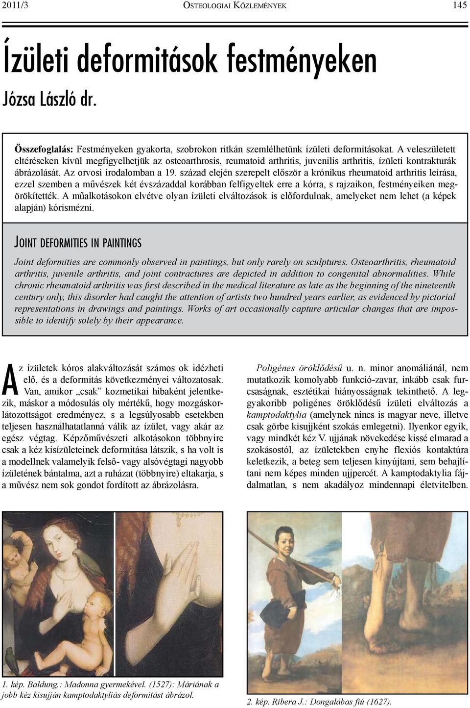 század elején szerepelt először a krónikus rheumatoid arthritis leírása, ezzel szemben a művészek két évszázaddal korábban felfigyeltek erre a kórra, s rajzaikon, festményeiken megörökítették.