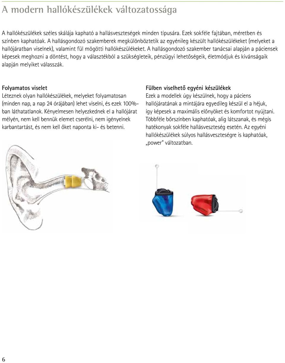 A hallásgondozó szakember tanácsai alapján a páciensek képesek meghozni a döntést, hogy a választékból a szükségleteik, pénzügyi lehetőségeik, életmódjuk és kívánságaik alapján melyiket válasszák.
