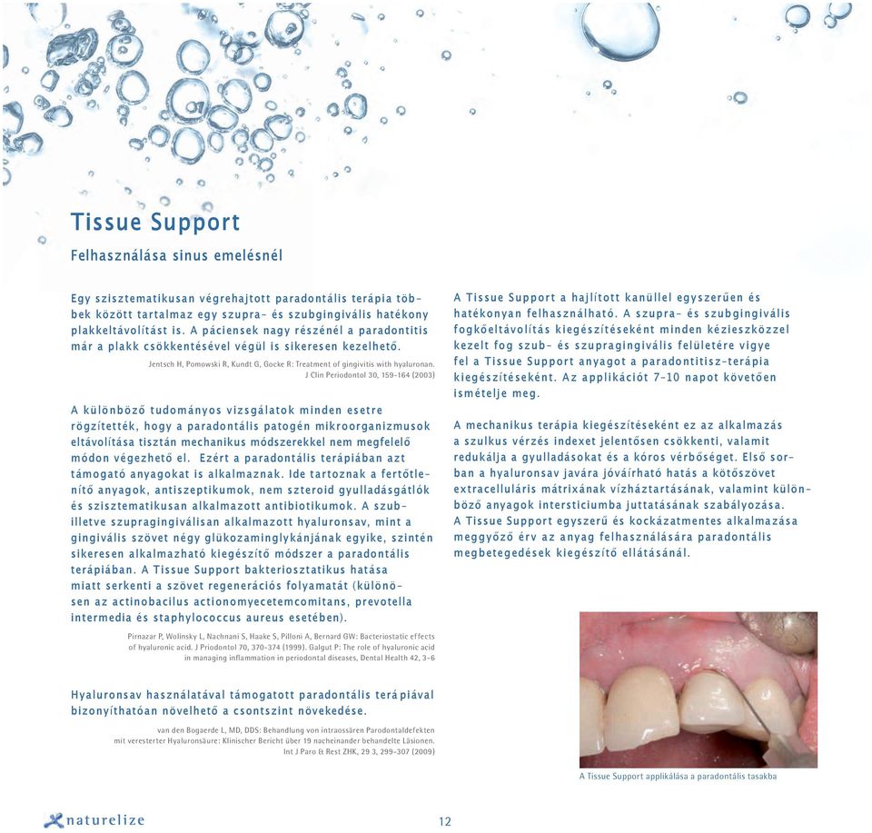 J Clin Periodontol 30, 159-164 (2003) A különb öző tudományos v izsgálatok minden esetre rögzítették, hogy a paradontális patogén mikroorganizmusok eltávolítása tisztán mechanikus módszerekkel nem