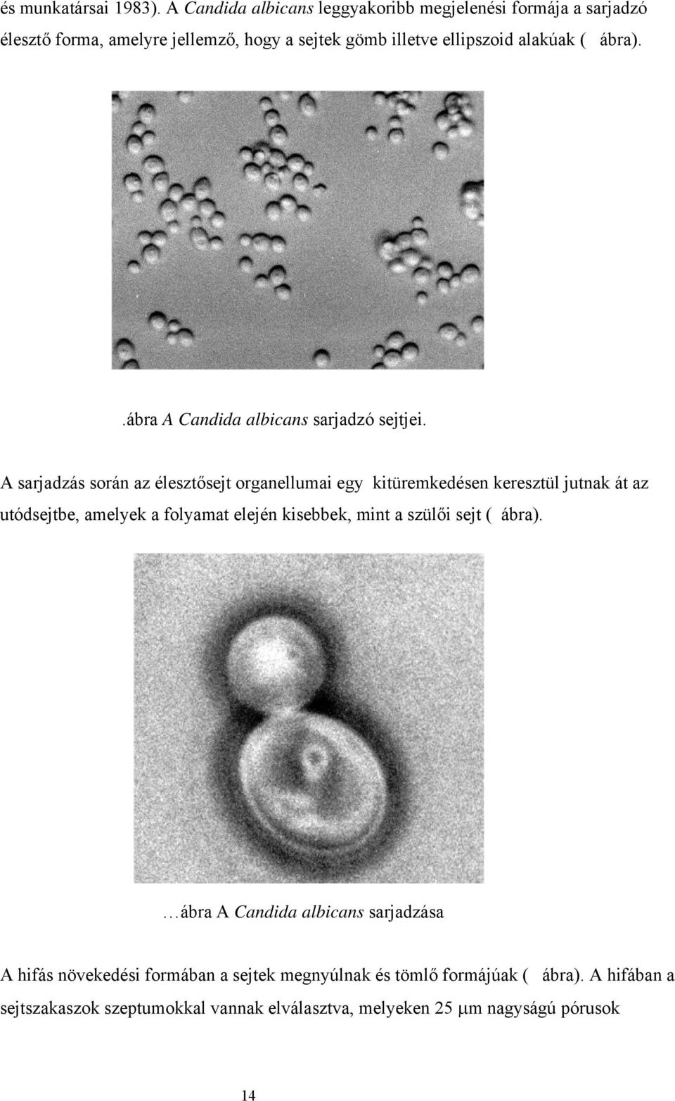 .ábra A Candida albicans sarjadzó sejtjei.