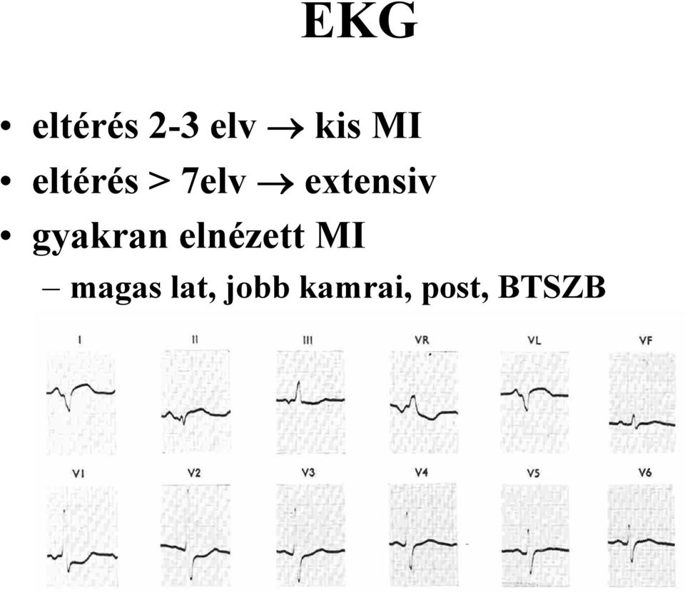 gyakran elnézett MI magas