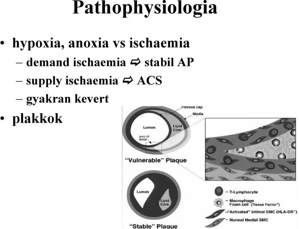 ischaemia stabil AP supply