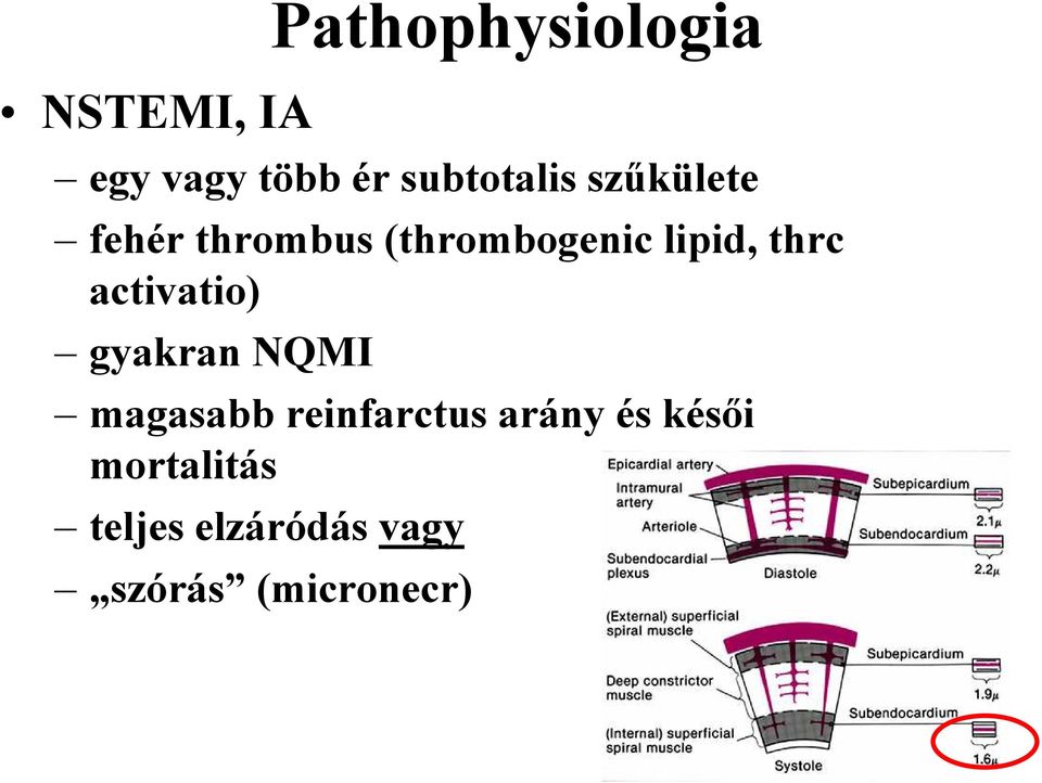 lipid, thrc activatio) gyakran NQMI magasabb