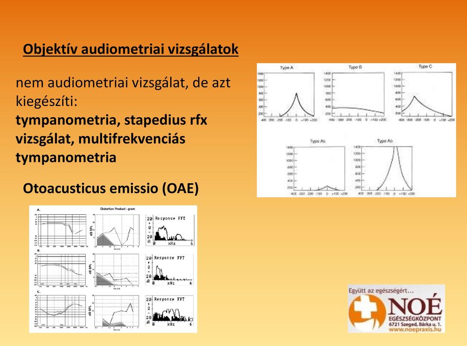 tympanometria, stapedius rfx vizsgálat,