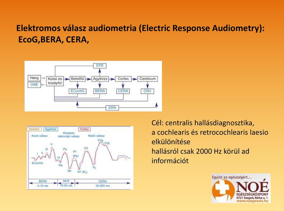 hallásdiagnosztika, a cochlearis és retrocochlearis