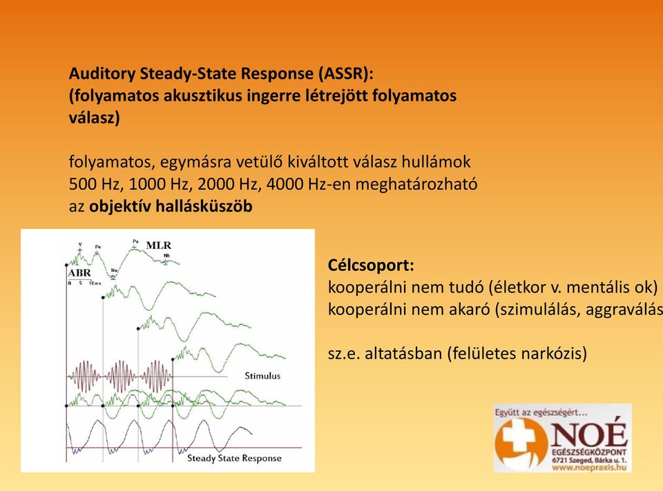 Hz-en meghatározható az objektív hallásküszöb Célcsoport: kooperálni nem tudó (életkor v.