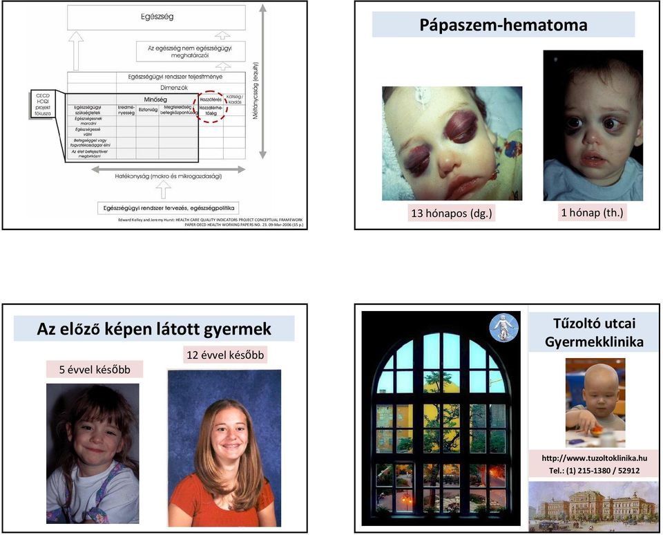 p) 13 hónapos (dg) 1 hónap (th) Az előző képen látott gyermek 5 évvel később 12