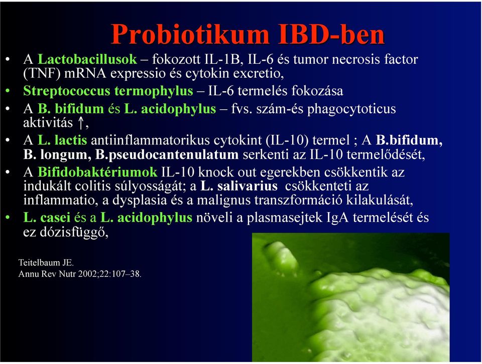 pseudocantenulatum serkenti az IL-10 termelődését, A Bifidobaktériumok IL-10 knock out egerekben csökkentik az indukált colitis súlyosságát; a L.