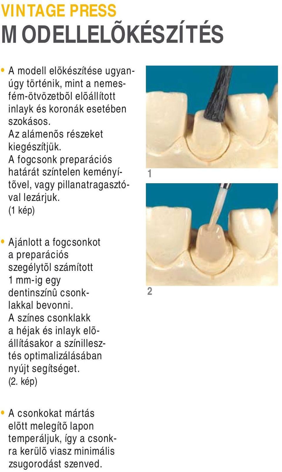 ( kép) Ajánlott a fogcsonkot a preparációs szegélytõl számított mm-ig egy dentinszínû csonklakkal bevonni.