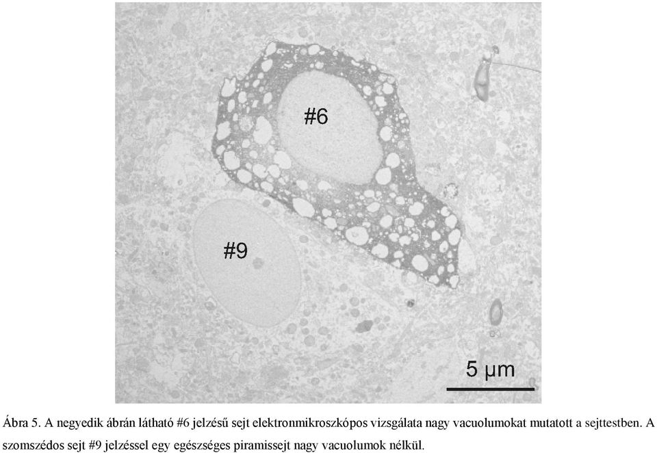 elektronmikroszkópos vizsgálata nagy vacuolumokat