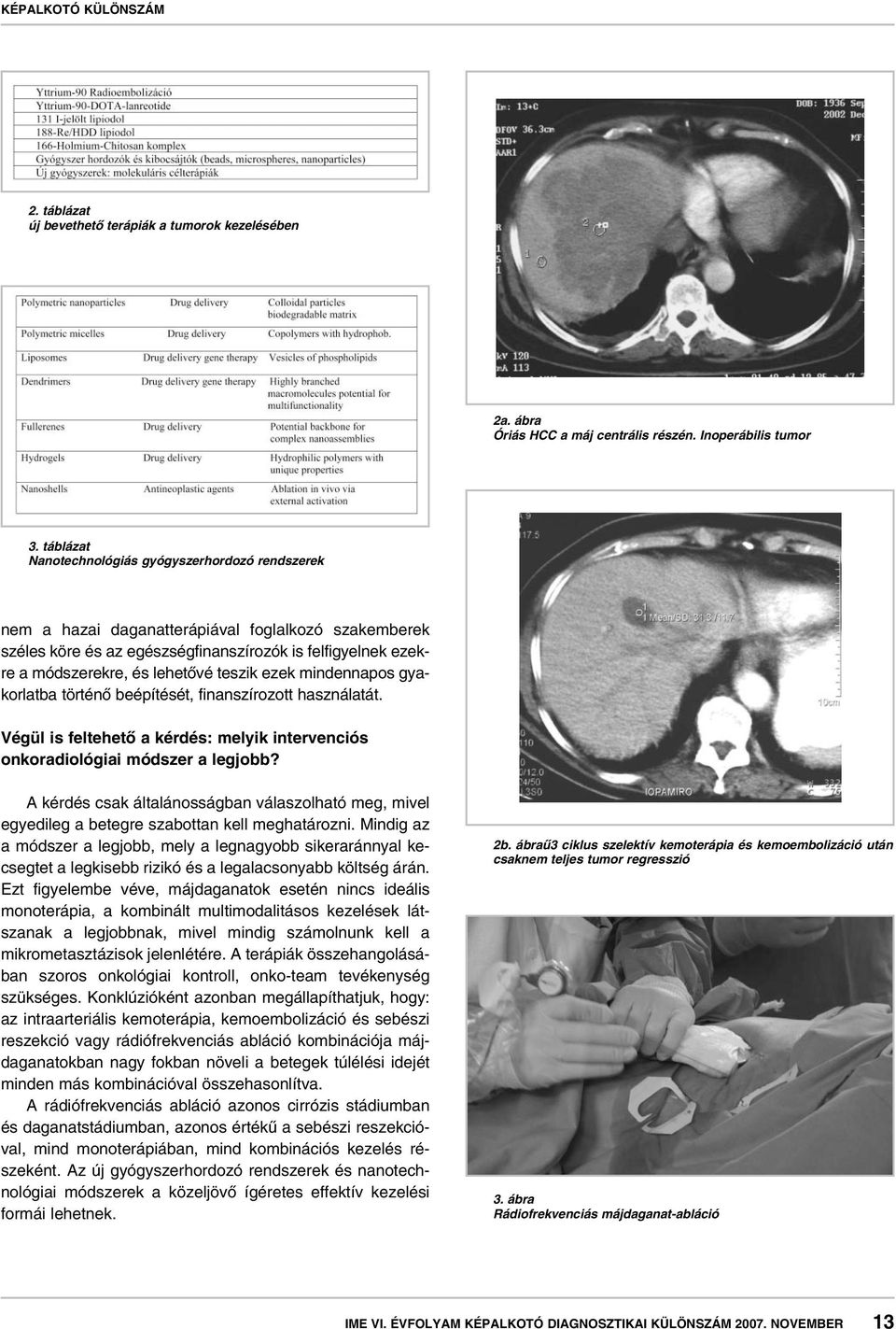 teszik ezek mindennapos gyakorlatba történô beépítését, finanszírozott használatát. Végül is feltehetô a kérdés: melyik intervenciós onkoradiológiai módszer a legjobb?