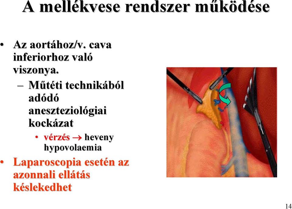 Műtéti technikából adódó aneszteziológiai kockázat