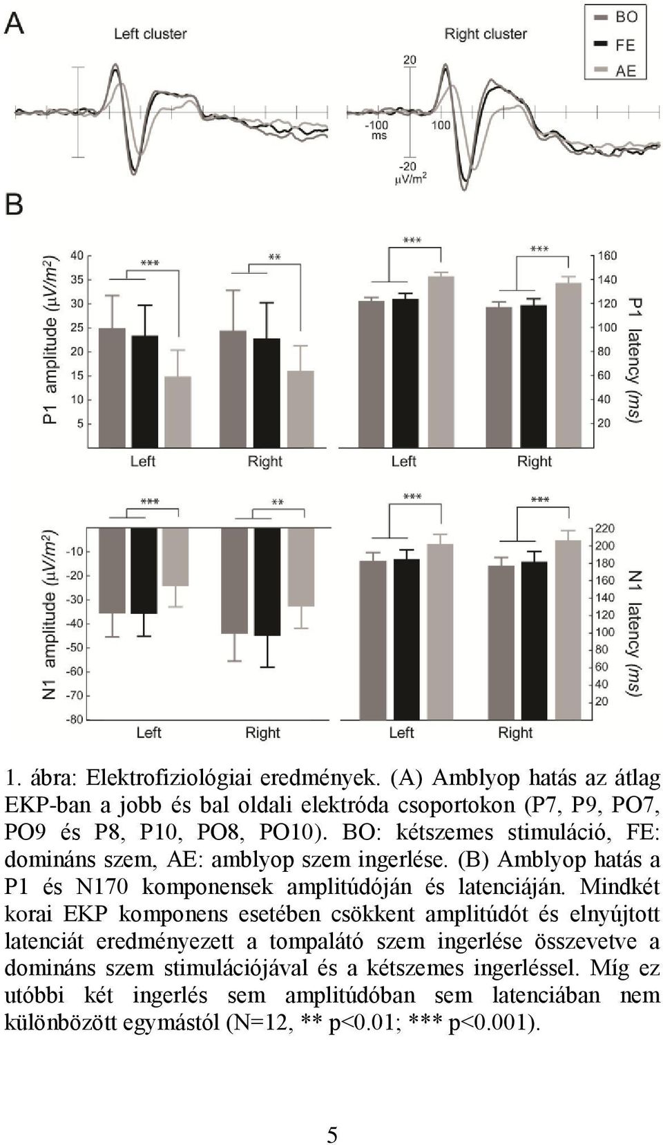 BO: kétszemes stimuláció, FE: domináns szem, AE: amblyop szem ingerlése. (B) Amblyop hatás a P1 és N170 komponensek amplitúdóján és latenciáján.