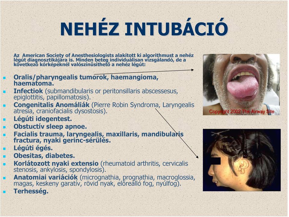Infectiok (submandibularis or peritonsillaris abscessesus, epiglottitis, papillomatosis). Congenitalis Anomáliák (Pierre Robin Syndroma, Laryngealis atresia, craniofacialis dysostosis).