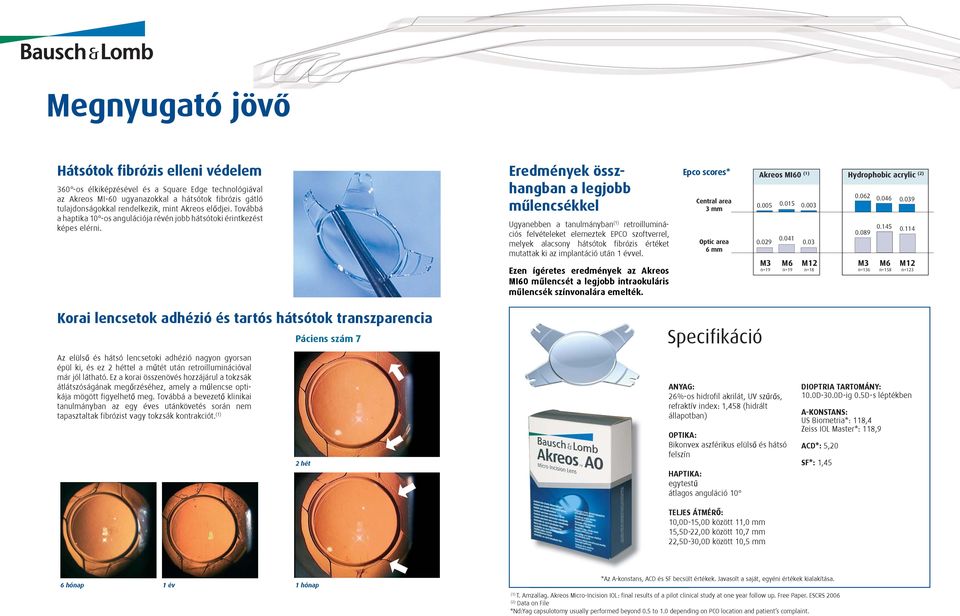 Eredmények összhangban a legjobb mûlencsékkel Ugyanebben a tanulmányban (1) retroilluminációs felvételeket elemeztek EPCO szoftverrel, melyek alacsony hátsótok fibrózis értéket mutattak ki az