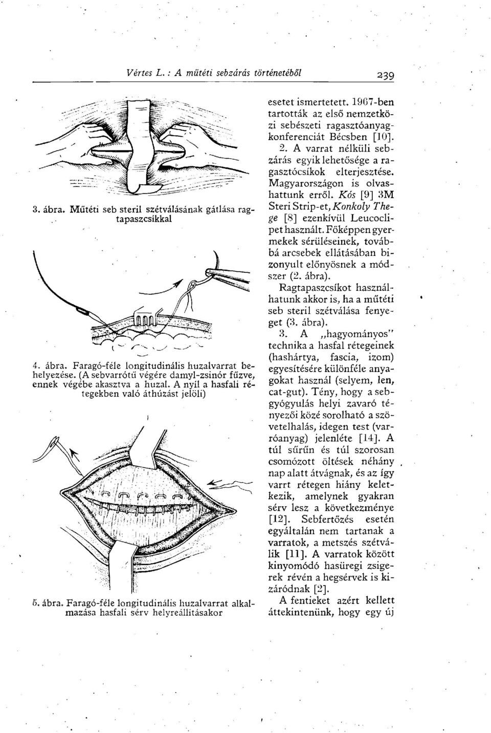Faragó-féle longitudinális huzalvarrat alkalmazása hasfali sérv helyreállításakor esetet ismertetett. 1907-ben tartották az első nemzetközi sebészeti ragasztóanyagkonferenciát Bécsben [10], 2.