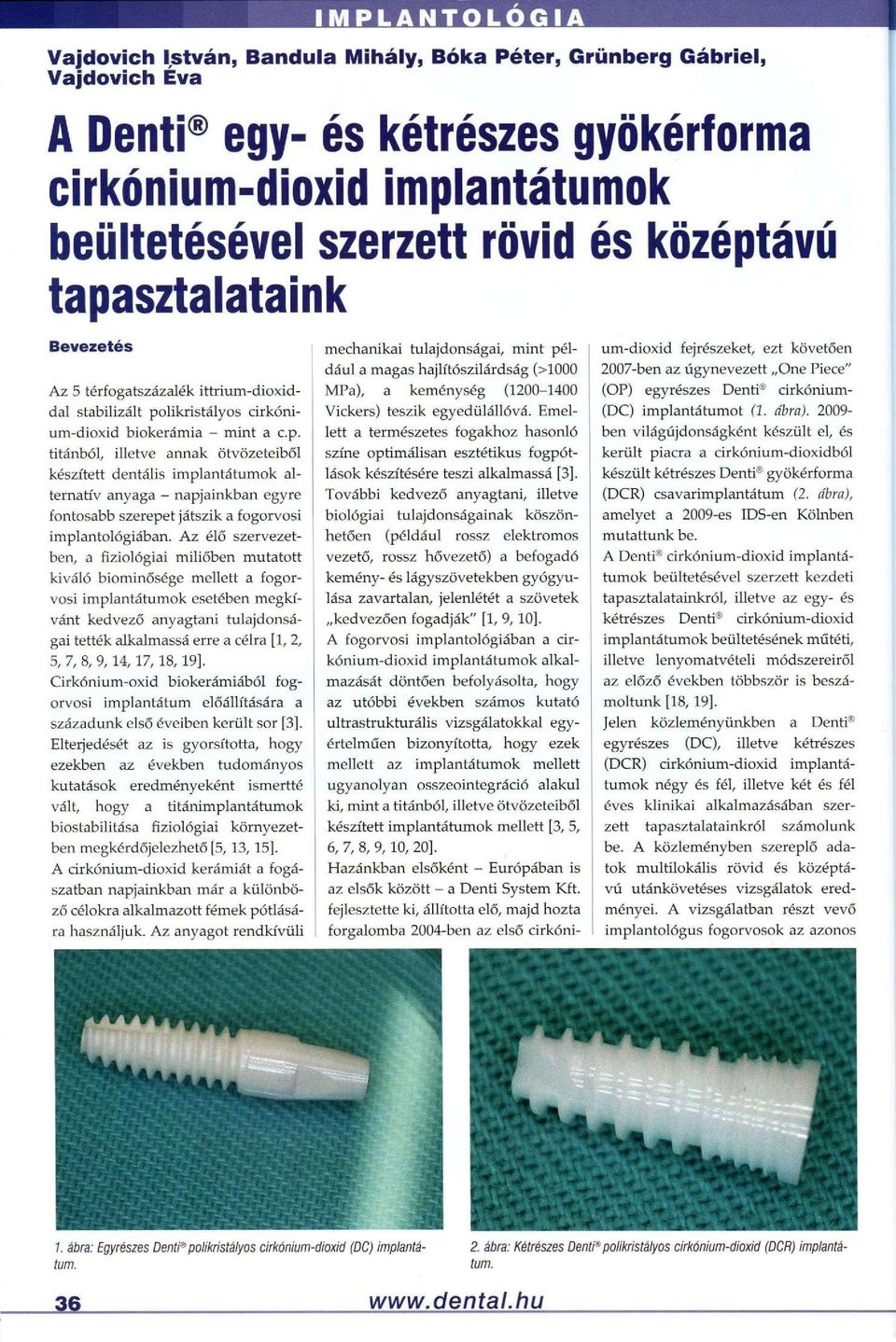 Az élő szervezetben, a fiziológiai miliőben mutatott kiváló biominősége mellett a fogorvosi implantátumok esetében megkívánt kedvező anyagtani tulajdonságai tették alkalmassá erre a célra [1, 2, 5,