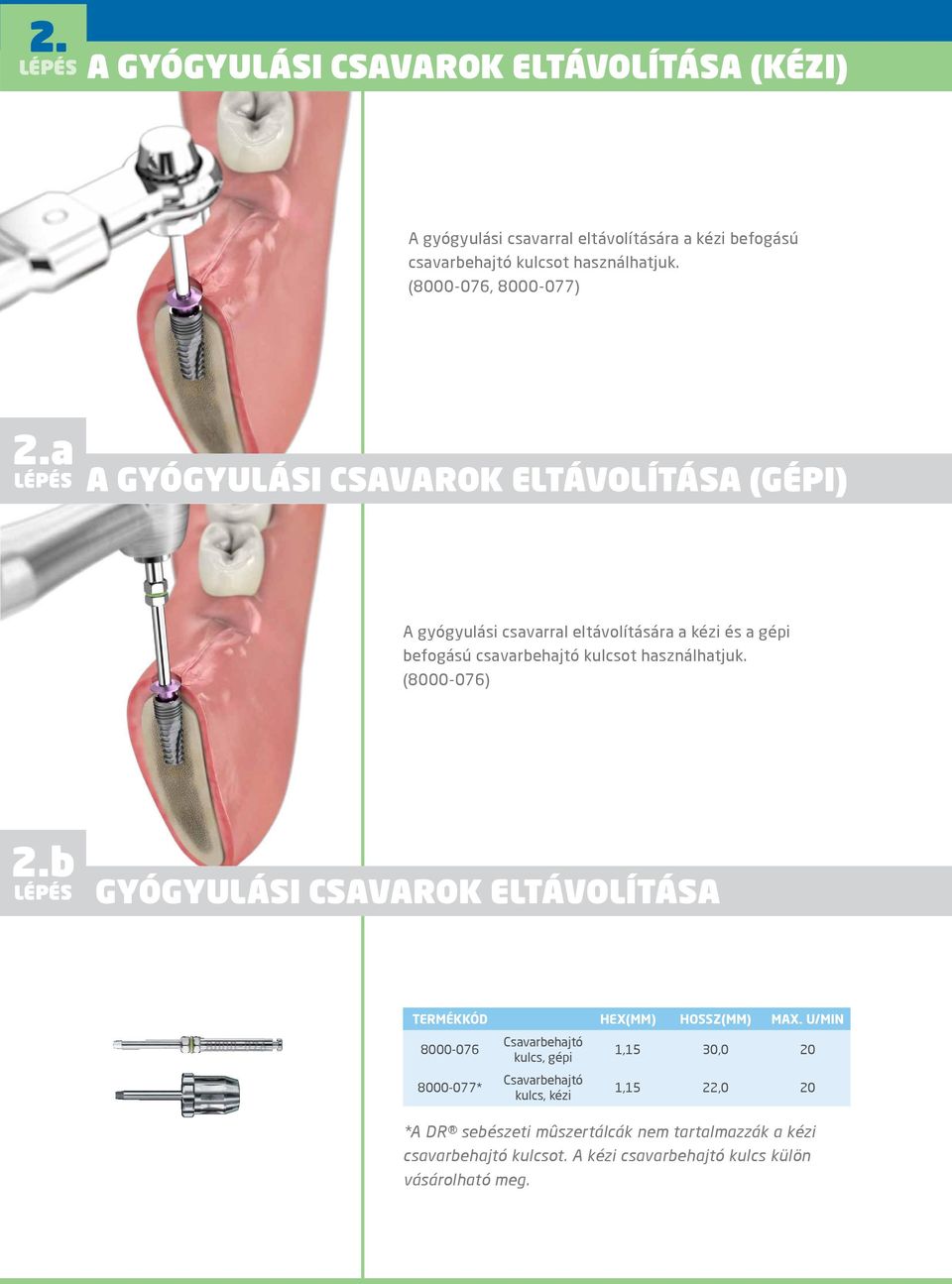 a A GYÓGYULÁSI CSAVAROK ELTÁVOLÍTÁSA (GÉPI) A gyógyulási csavarral eltávolítására a kézi és a gépi befogású csavarbehajtó kulcsot használhatjuk.