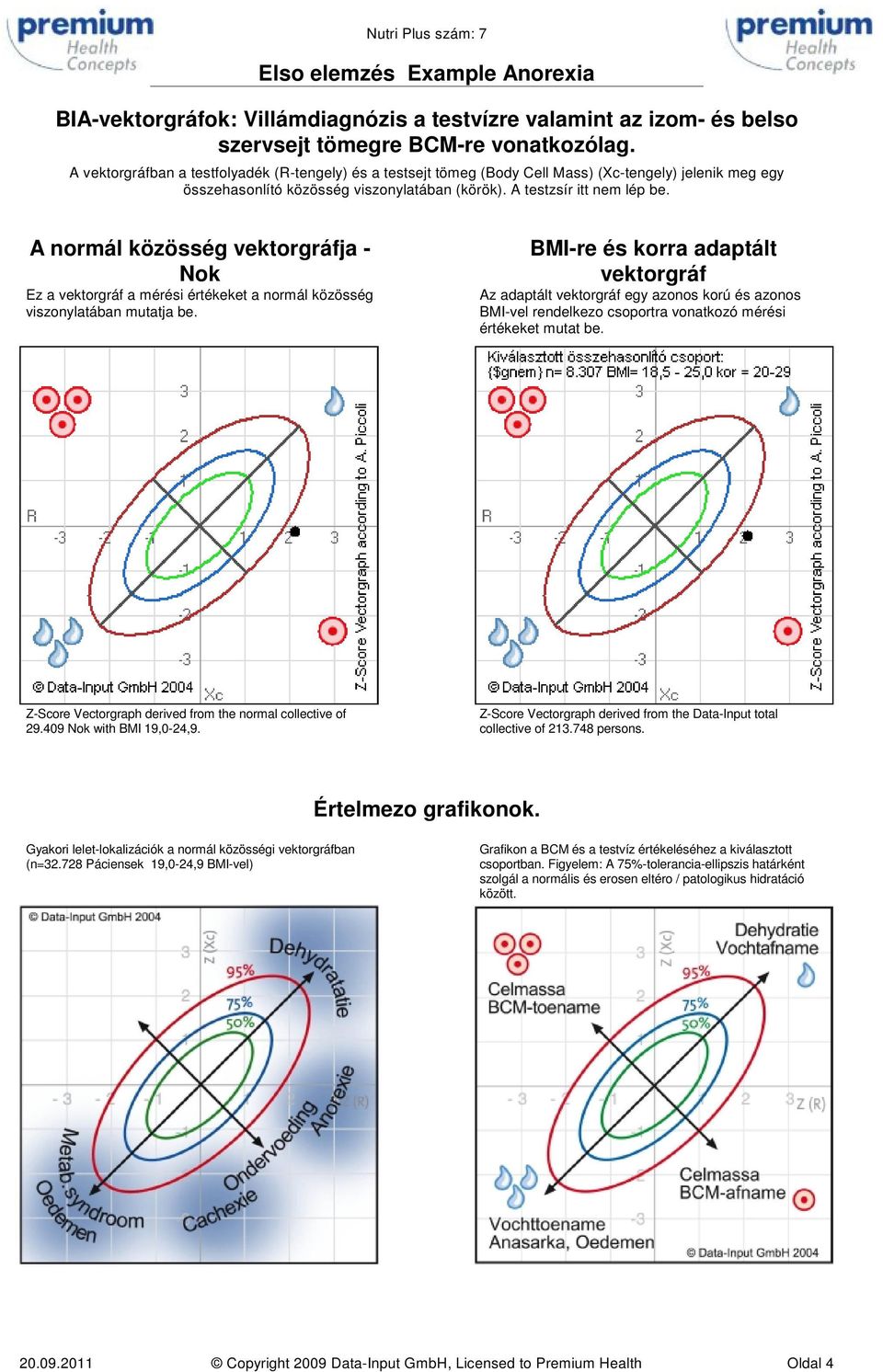 A normál közösség vektorgráfja - Nok Ez a vektorgráf a mérési értékeket a normál közösség viszonylatában mutatja be.