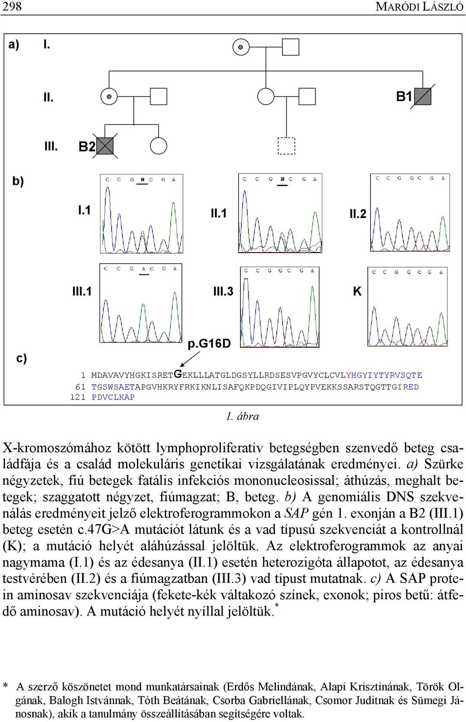 ábra X-kromoszómához kötött lymphoproliferatív betegségben szenvedő beteg családfája és a család molekuláris genetikai vizsgálatának eredményei.