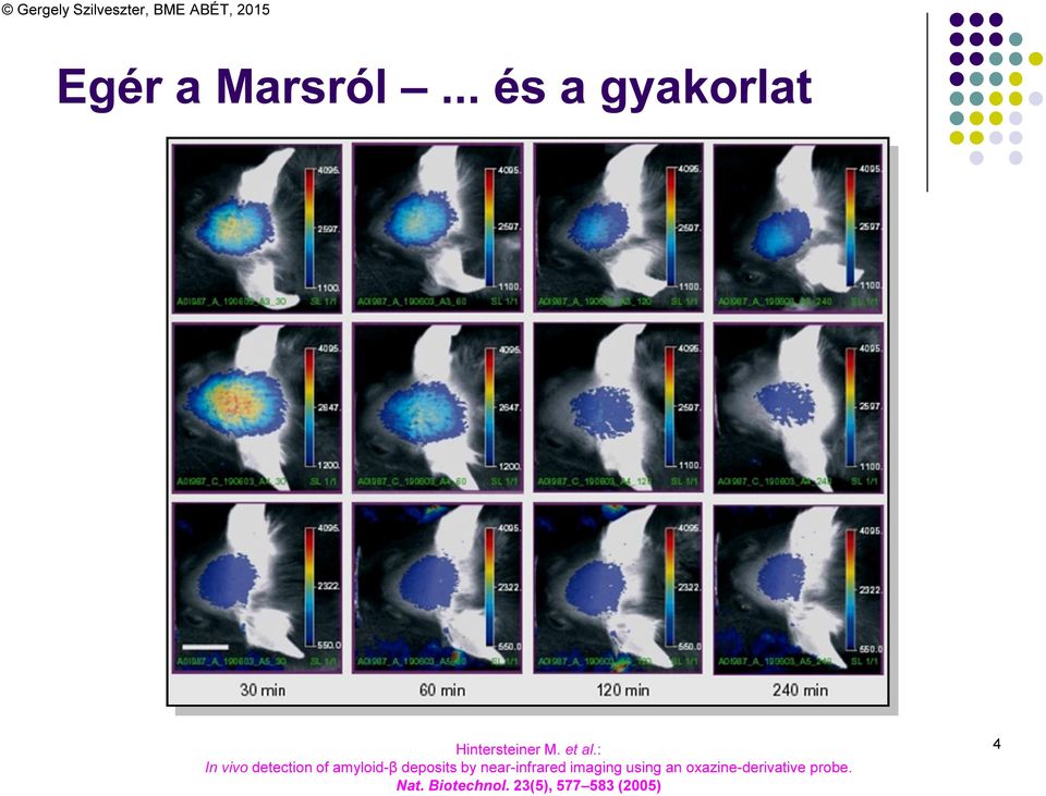 : In vivo detection of amyloid-β deposits by