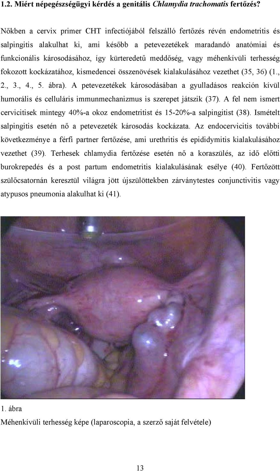 kürteredetű meddőség, vagy méhenkívüli terhesség fokozott kockázatához, kismedencei összenövések kialakulásához vezethet (35, 36) (1., 2., 3., 4., 5. ábra).