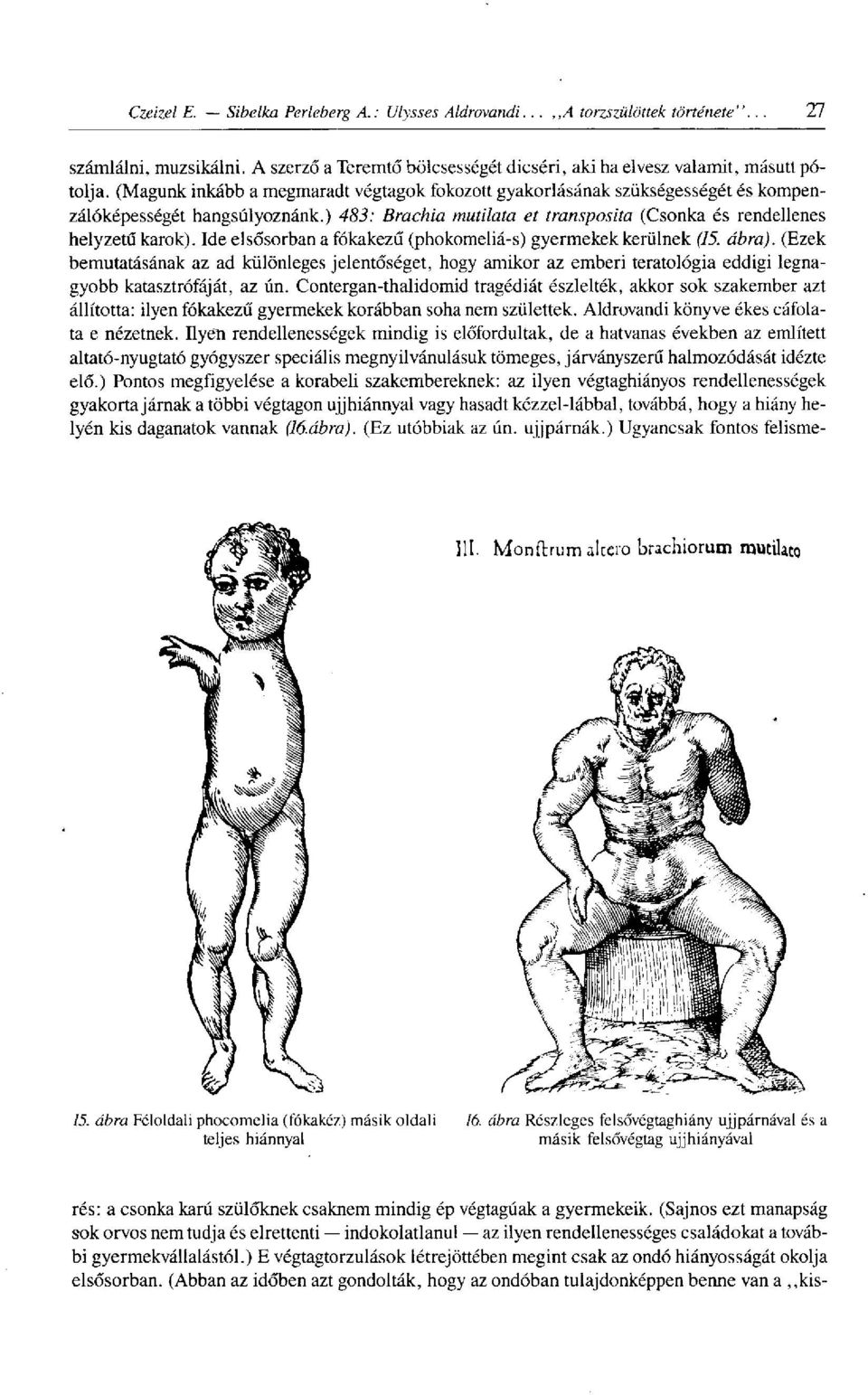 Ide elsősorban a fókakezű (phokomeliá-s) gyermekek kerülnek (75. ábra). (Ezek bemutatásának az ad különleges jelentőséget, hogy amikor az emberi teratológia eddigi legnagyobb katasztrófáját, az ún.