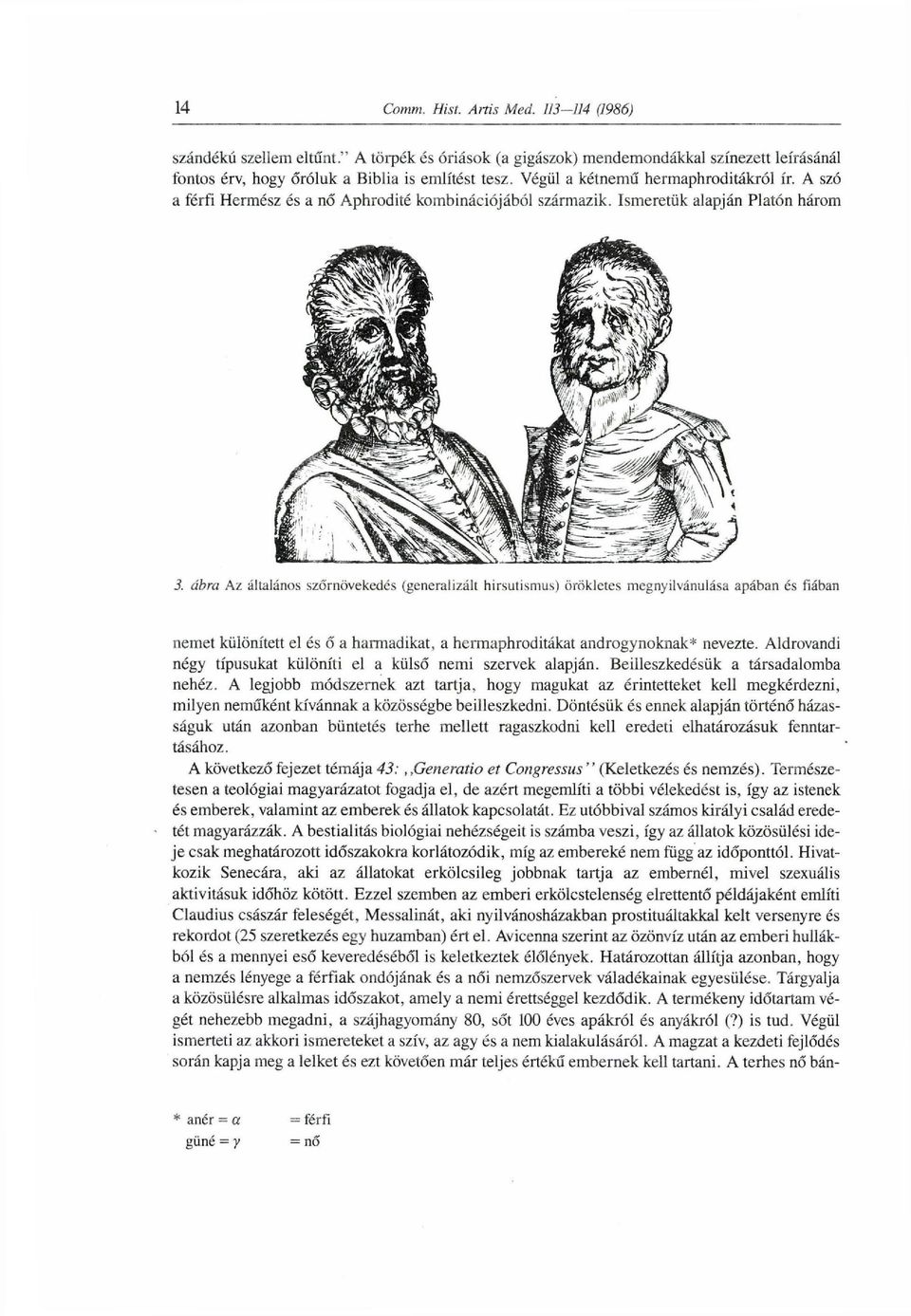 ábra Az általános szőrnövekedés (generalizált hirsutismus) örökletes megnyilvánulása apában és fiában nemet különített el és ő a harmadikat, a hermaphroditákat androgynoknak* nevezte.