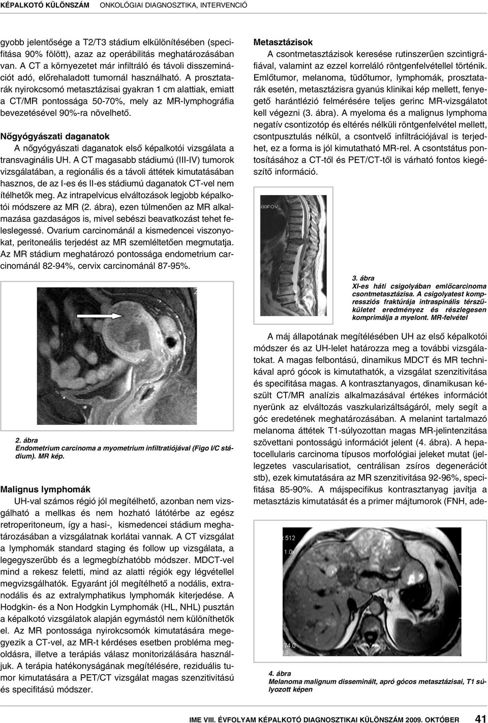 A prosztatarák nyirokcsomó metasztázisai gyakran 1 cm alattiak, emiatt a CT/MR pontossága 50-70%, mely az MR-lymphográfia bevezetésével 90%-ra növelhetô.