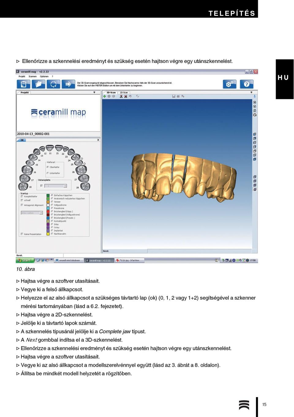 Jelölje ki a távtartó lapok számát. A szkennelés típusánál jelölje ki a Complete jaw típust. A Next gombbal indítsa el a 3D-szkennelést.