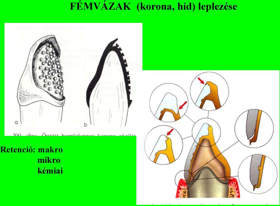 FÉMVÁZAK