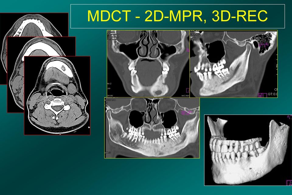 3D-REC