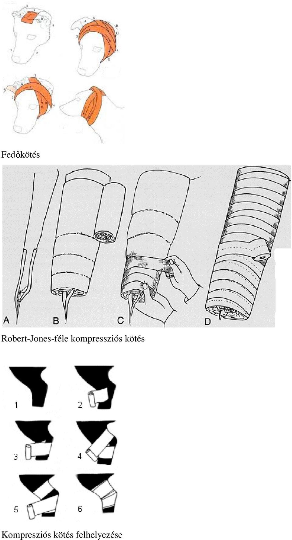 kompressziós kötés